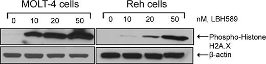 Figure 6. LBH589 induces phosphorylation of histone H2A.X. Cells were treated with the indicated concentrations of LBH589 for 24 hours. Subsequently, Western blot analysis of phosphorylated histone H2A.X was performed on the cell lysates from MOLT-4 and Reh cells. The levels of β-actin served as loading controls. Results are representative of 3 independent experiments.