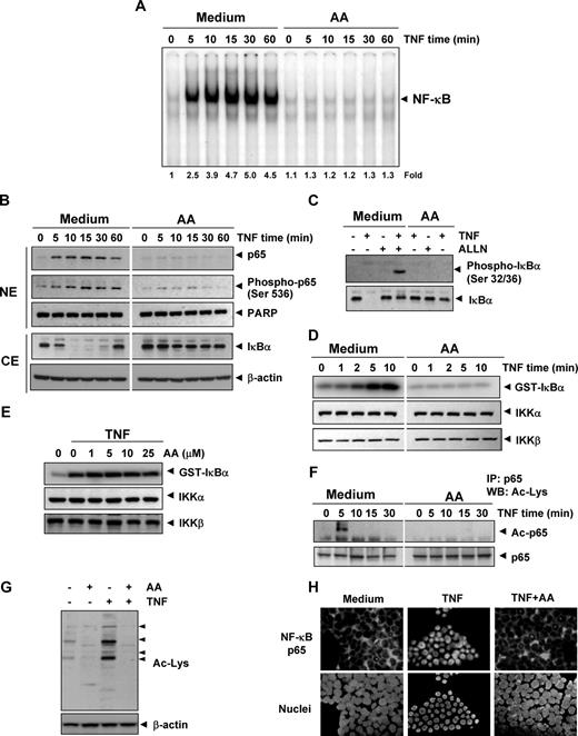 Figure 4. Anacardic acid inhibits TNF-dependent IκBα phosphorylation, IκBα degradation, p65 phosphorylation, and p65 nuclear translocation. (A) Anacardic acid inhibits TNF-induced activation of NF-κB. KBM-5 cells were incubated with 25 μmol/L anacardic acid for 4 hours, treated with 0.1 nmol/L TNF for the indicated times, and then analyzed for NF-κB activation by EMSA. (B) Effect of anacardic acid on TNF-induced IκBα degradation, p65 phosphorylation, and p65 nuclear translocation. Cells were incubated with 25 μmol/L anacardic acid for 4 hours and treated with 0.1 nmol/L TNF for the indicated times. Cytoplasmic extracts (CE) and nuclear extracts (NE) were prepared, fractionated on SDS-PAGE, and electrotransferred to nitrocellulose membrane. Western blot analysis was performed using the indicated antibody. An anti–β-actin antibody was the loading control. (C) Effect of anacardic acid on the phosphorylation of IκBα by TNF. Cells were preincubated with 25 μmol/L anacardic acid for 4 hours, incubated with 50 μg/mL ALLN for 30 minutes, and then treated with 0.1 nmol/L TNF for 10 minutes. Cytoplasmic extracts were fractionated and then subjected to Western blot analysis using a phospho-specific anti-IκBα antibody. The same membrane was reblotted with anti-IκBα antibody. (D) Anacardic acid inhibits TNF-induced IκBα kinase activity. Whole-cell extracts were immunoprecipitated with antibody against IKKα and analyzed by an immune complex kinase assay. To examine the effect of anacardic acid on the level of expression of IKK proteins, whole-cell extracts were fractionated on SDS-PAGE and examined by Western blot analysis using anti-IKKα and anti-IKKβ antibodies. (E) Direct effect of anacardic acid on IKK activation induced by TNF. Whole-cell extracts were prepared from KBM-5 cells treated with 1 nmol/L TNF and immunoprecipitated with anti-IKKα antibody. The immunocomplex kinase assay was performed in the absence or presence of the indicated concentration of anacardic acid. (F) Effect of anacardic acid on TNF-induced acetylation of p65. Cells were treated with 25 μmol/L anacardic acid for 4 hours and then exposed to 1 nmol/L TNF. Whole-cell extracts were prepared, immunoprecipitated with an anti-p65 antibody, and subjected to Western blot analysis using an anti–acetyl-lysine antibody. The same blots were reprobed with anti-p65 antibody. (G) Effect of anacardic acid on TNF-induced protein acetylation. Cells were treated with 25 μmol/L anacardic acid for 4 hours and then exposed to 1 nmol/L TNF for 20 minutes. Whole cell extracts were prepared and subjected to Western blot analysis using an anti–acetyl-lysine antibody. (H) Immunocytochemical analysis of p65 localization. Cells were incubated with 25 μmol/L anacardic acid for 4 hours and then treated with 1 nmol/L TNF for 15 minutes. Cells were subjected to immunocytochemical analysis.