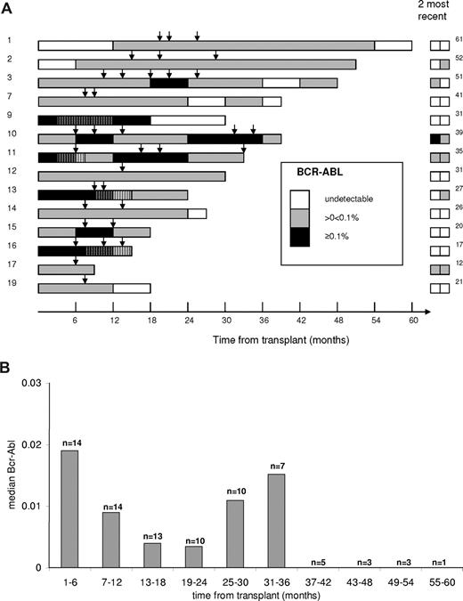 Figure 1. Quantitative reverse-transcribed polymerase chain reaction results for BCR-ABL ratio after RISCT. (A) The patient trial numbers are listed in the first vertical column. Results shown are mean values for each completed 6-month period. To allow presentation of more recent data, the mean of the most recently completed 3-month period is also shown on the bars of patients 7, 13, 15, and 16. Arrows represent timing of DLI, and close vertical bars represent periods of IM therapy. The right-hand column shows the 2 most recent sequential results and is accompanied by the current follow-up time (in months) after transplant. Patient 4 died at 12 months and is not illustrated, as the single positive BCR-ABL result obtained during follow-up was not quantified; in all other samples, BCR-ABL transcripts were undetectable. This patient did not receive DLI. (B) Median BCR-ABL results over 6-month periods after RISCT. The number of patients for whom data were available at each time point is indicated above each column. Patient 4 is not included because, where a positive result was obtained, this was not quantified.
