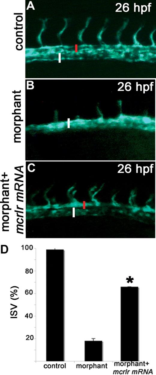 Figure 3. Murine crlr overexpression rescues the vascular phenotype in zebrafish crlr morphants. Murine crlr mRNA was injected in VEGFR2:G-RCFP crlr morphants, and axial vasculature of the trunk was examined under an epifluorescence microscope at 26 hpf. The reduction in size of DA (red bar) and the delay in ISV development observed in crlr morphants (B) are rescued by murine crlr overexpression (C). (A) control VEGFR2:G-RCFP embryo. PCV is indicated by the white bar. The percentage of embryos showing normal ISV development in the different experimental groups is shown in panel D. Data are the mean plus or minus SD of 2 independent experiments with 15 embryos per group. *Statistically different from the “morphant” group; P < .02, Student t test.