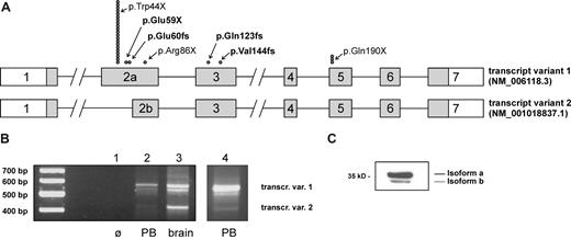 Figure 1. HAX1 transcript variants and summary of known mutations in patients with CN. (A) The intron-exon structure with the coding region (▒) for both isoforms of the HAX1 gene is shown. ● indicates the position of the mutations; each symbol represents a single patient (mutations were homozygous in all patients). Novel mutations are printed in bold letters. (B) Expression of transcript variants in peripheral blood cells (PB) and brain tissue. cDNAs from peripheral blood mononuclear cells (lanes 2 and 4) and from human brain (lane 3) have been amplified as described in “Methods.” A distinct band for transcript variant 2 could be detected only after secondary PCR (lane 4). The identity of transcript variants 1 and 2 has been confirmed by sequencing. The band migrating between the 2 variants consisted of heteroduplices of the 2 variants as confirmed by sequencing. (C) Expression of HAX1 isoforms in the HL-60 cell line. Western blot analysis was performed with total-cell lysate.