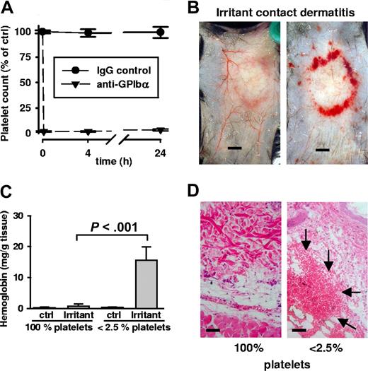 Figure 1. Bleeding in irritant contact dermatitis in thrombocytopenic mice. (A) Thrombocytopenia was achieved by administration of a rat antimouse GPIbα antibody. Platelet counts were determined at indicated time points and displayed in relation to the baseline level (100%). Platelet depletion occurred within minutes (first data point = 0.1 hours) and platelet counts remained < 2.5% for or over 24 hours). Control IgG antibody injection did not alter platelet counts. (B) WT mice were subjected to irritant contact dermatitis (ICD) in the presence and absence of platelets. Erythema and edema were seen in both groups, while massive bleeding into the skin at the inflammatory ring was seen only in thrombocytopenic mice (right). Mice were killed 4 hours after stimulation. Bar = 5 mm. (C) Hemoglobin content in biopsies of the ICD-treated skin. Control skin has barely detectable levels of hemoglobin that were significantly elevated in the inflamed skin of thrombocytopenic mice (P < .001; n = 5). Error bars represent SEM. (D) Skin sections stained with hematoxylin and eosin show massive RBC accumulation (arrows) in the tissue only of ICD-challenged thrombocytopenic animals. Bar = 40 μm.