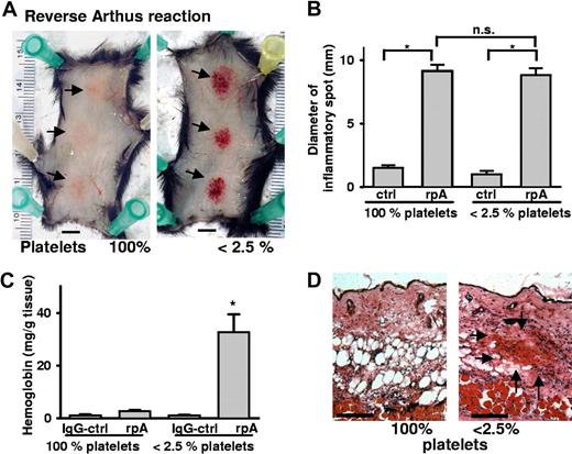 Figure 2. Hemorrhage at sites of the reverse passive Arthus reaction in platelet-depleted mice. (A) Mice were subjected to rpA () in the presence and absence of platelets and killed at 4 hours. Erythema was seen in control mice (left), while massive petechial bleeding was observed only in thrombocytopenic animals (right). Bar = 5 mm. (B) Evans blue leakage into the tissue was measured to assess the size of the inflammatory area. No differences were found between control and platelet-depleted animals. (C) Hemoglobin content in biopsies of the inflamed and control skin. Induction of the rpA, but not the IgG control, led to significantly elevated Hb levels in thrombocytopenic mice (*P < .001; n = 4). Error bars represent SEM. (D) Skin sections stained with H&E revealed accumulation of RBCs () in the inflamed skin of thrombocytopenic mice. Bar = 100 μm.