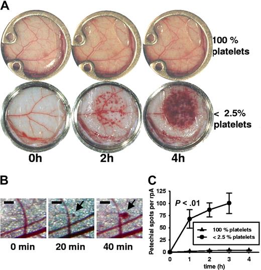 Figure 3. Kinetics of inflammatory bleeding in thrombocytopenic mice during reverse passive Arthus reaction. (A) Photographs of progressing rpA in the dorsal skinfold chamber. In the absence of platelets, petechial bleeding was clearly visible after 2 hours and increased with time. In nondepleted animals there were virtually no petechial spots. Window diameter was 12 mm. (B) Microscopic view of the progressing rpA in a thrombocytopenic mouse. Petechial bleeding was detected at 20 minutes, with further growth of the spot at 40 minutes. Bar = 200 μm. (C) Petechial spots visible to the eye (∼ 100 μm) were counted during rpA in thrombocytopenic and control animals. The difference in incidence of petechiae became statistically significant within 1 hour (P < .01; n = 4). At t = 4 hours, the petechiae became confluent, impairing quantification. Error bars represent SEM.