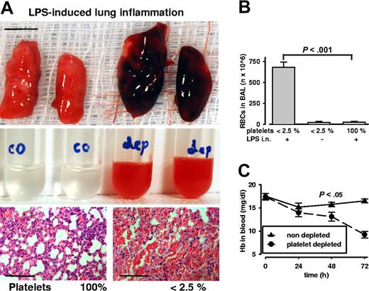 Figure 6. Lung inflammation induces severe hemorrhage and anemia during thrombocytopenia. (A) Top: Postmortem analysis of lungs after intranasal LPS challenge. Massive pulmonary hemorrhage is observed in platelet-depleted lungs on the right. Bar = 5 mm. Middle: Bronchoalveolar lavage reveals red opaque fluid from depleted (dep) mice and not from control (co) mice with normal platelet count. Bottom: Lung sections stained with hematoxylin and eosin show massive RBC infiltration in airways and alveolar space of thrombocytopenic mice. Bar = 100 μm. (B) Significantly increased amounts of RBCs were found in the lavage of inflamed thrombocytopenic mice (P < .001; n = 5). Platelet depletion per se did not induce RBC loss into the lung. (C) Hemoglobin levels in whole blood of thrombocytopenic and control mice challenged in the lung inflammation model. Pulmonary hemorrhage is accompanied by a significant drop in hemoglobin levels in the thrombocytopenic animals. Error bars represent SEM.