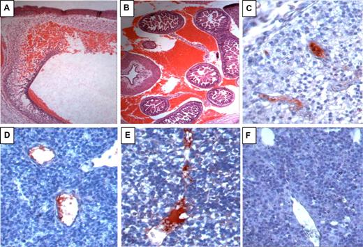 Figure 3. Hemorrhage and intravascular coagulation in E13.5 FV(λ/λ)/ZPI(−/−) embryos. A-E, FV(λ/λ)/ZPI(−/−) embryos; F, FV(λ/λ)/ZPI(+/+) embryo. A,B, hematoxylin-eosin staining; C-F, antifibrinogen/fibrin staining (red) developed using AEC with hematoxylin counterstaining. (A) Intracranial hemorrhage (×5). (B) Intra-abdominal hemorrhage (×5). (C-E) Intravascular fibrin in the vessels of the brain (C, ×40), lung (D, ×40), and liver (E, ×40). In addition to the intravascular thrombosis, note disturbed cellular architecture and parenchymal fibrinogen/fibrin staining in the liver of the FV(λ/λ)/ZPI(−/−) embryo (E) compared with the liver of the FV(λ/λ)/ZPI(+/+) embryo (F).