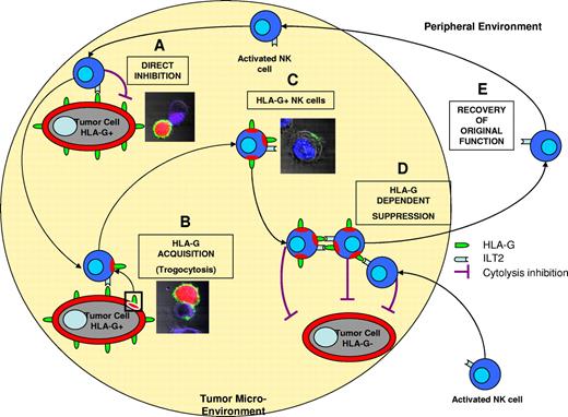 Figure 3. Emergency immune suppression: a possible impact of HLA-G trogocytosis on immune responses. Within the microenvironment of a tumor, for example, in which some cells express HLA-G and some do not (A), the function of activated natural killer (NK) cells is directly blocked by the interaction of tumor cell HLA-G and NK-cell immunoglobulin-like transcript 2 (ILT2). This results in the immune escape of the HLA-G–positive tumor cell. (B) During this cell-to-cell contact, tumor cell-membrane patches containing HLA-G are acquired by activated NK cells within minutes (through a process known as trogocytosis). (C) This results in the generation of HLA-G–positive activated NK cells, which can inhibit other HLA-G–positive (cross-inhibition) or HLA-G–negative NK cells through HLA-G and ILT2 cross-linking (D). This suppressive function of HLA-G–positive NK cells results in the immune escape of HLA-G–negative tumor cells. (E) Immune suppression does not spread as NK cells do not translate HLA-G de novo and lose its surface expression quickly if not in the vicinity of HLA-G–positive tumor cells. Emergency immune suppression and in situ generation of regulatory cells, which is fast, local and temporary, might constitute an efficient mechanism of immune escape.