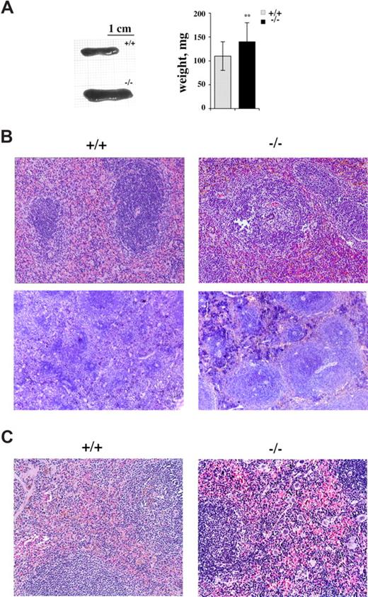 Figure 3. Splenomegaly and white and red pulp expansion in p66Shc−/− mice. (A) Representative image of spleen from age-matched control (+/+) or p66Shc−/− (−/−) mice (left) and histogram showing the weight mean values (± SD; control, gray; p66Shc−/−, black; right). Note the significant increase in size of the mutant spleen in p66Shc-deficient mice (n = 19; **P < .01). (B,C) Histologic analysis of spleen tissue from 12-month-old control (+/+) or p66Shc−/− (−/−) mice. (B) Hematoxylin and eosin (H&E; top, 100×) and Giemsa (bottom, 50 ×) staining of spleen sections from 12-month-old control (+/+) or p66Shc−/− (−/−) mice showing normal architecture in wild-type mice versus white pulp hyperplasia with florid germinal centers (GCs) in p66Shc−/− mice (n ≥ 3). Average number of follicles per full longitudinal section (mean ± SD): 40.75 (± 14) in p66Shc−/− mice versus 19.75 (± 4.4) in control mice; average number of germinal centers: 12.25 (± 3.3) in p66Shc−/− mice versus 3.25 (± 1.1) in control mice (n = 4). Germinal centers were only sporadically observed in lymph node sections, without any significant difference between p66Shc−/− and control mice (not shown). (C) Histologic analysis of splenic red pulp in 12-month-old control (+/+) or p66Shc−/− (−/−) mice. The red pulp is characterized, in p66Shc−/− mice, by largely increased extramedullary hematopoiesis (note the megakaryocytes and the islands of erythropoiesis; H&E, 100×, n ≥ 3).