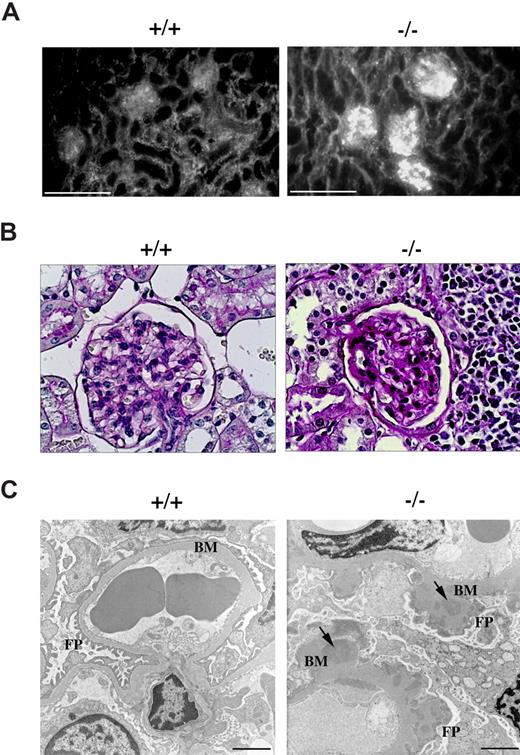 Figure 6. p66Shc−/− mice develop glomerulonephritis. Immunofluorescence, periodic acid-Schiff (PAS) staining, electronic microscopy of kidney from 12-month-old control (+/+) or p66Shc−/− (−/−) mice. (A) Ig analysis by fluorescence staining with FITC-conjugated anti–mouse IgG reveals immune complexes diffusely deposited in the glomeruli of kidneys from p66Shc−/− mice not observed in controls. Scale bar represents 100 μm (n ≥ 7). (B) Histology of PAS-stained kidney sections shows normocellular glomerulus in wild-type mice and diffuse increase in thickening of glomerular basal membrane in p66Shc−/− mice (400×, n ≥ 3). (C) Ultrastructural analysis of uranyl acetate–stained frozen kidney sections by transmission electron microscopy shows thickening of glomerular basement membranes (BM) in p66Shc−/− mice versus controls. The external face of the basement membranes of p66Shc−/− glomeruli appears coarse and irregular, with a clear effacement of foot processes (FPs). Electron dense patches within the thickness of the basement membranes represent immune complex deposits (↘). Scale bar represents 2 μm (n ≥ 14).