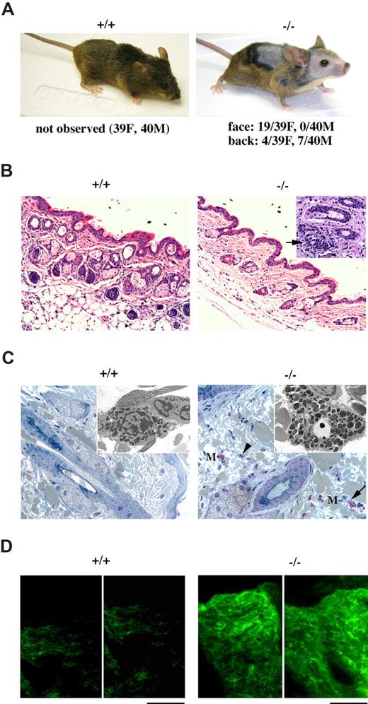 Figure 7. p66Shc−/− mice develop lupus-like alopecia. (A) Representative pictures of control (+/+) and p66Shc−/− (−/−) mice with alopecia. At the bottom, the frequencies of alopecia in the face and scalp or in the back of female (F) and male (M) mice are reported. The incidence of the lesions was not affected by the number of mice per cage. No microorganisms were found by either light or electron microscopy. (B) Histologic analysis of skin sections. H&E stained shows thinning of dermis and reduction in size and number of hair follicles in p66Shc−/− mice (100×). The inset shows lymphatic infiltration around and within the hair follicles (arrow) (200×) (n ≥ 3). (C) Toluidine blue–stained skin sections display numerous infiltrated mast cells (magenta, M) in p66Shc−/− mice versus controls (200×). The arrow indicates a degranulating mast cell. The arrowhead shows an infiltrated neutrophil. Loosening of dermal collagen fibers due to edema can be observed. The inset shows an electronic micrograph of an activated mast cell in an alopecic skin section from a p66Shc−/− mouse, characterized by the presence of abundant large granules throughout the cytoplasm, some of which appear to be releasing their contents to the extracellular space (n ≥ 3). (D) Analysis of Ig deposit by fluorescence staining with FITC-conjugated goat anti–mouse immunoglobulins displays immune complexes deposited in the dermal layer of the skin from p66Shc−/− mice. Scale bar represents 100 μm (n ≥ 4).