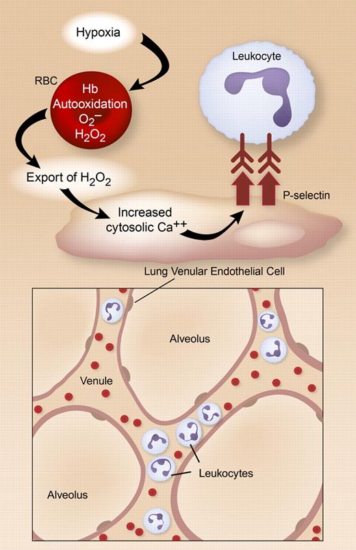 In hypoxic rodent lungs, H2O2 is generated in RBCs by auto-oxidation of membrane-bound Hb and is exported to microvascular endothelial cells. This triggers increased cytosolic calcium, translocation of P-selectin to the EC plasma membrane, and leukocyte adhesion in venules and septal capillaries. Illustration by Diana Lim.