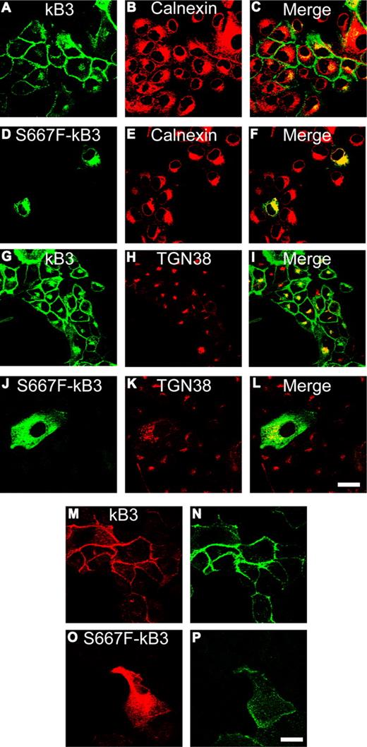 Figure 5. Expression of S667F-kB3 in nonpolarized MDCK1 cells. (A-P) MDCK1 cells stably expressing normal kB3 or mutant S667F-kB3 that were grown on coverslips and fixed (A-L), or washed, incubated with the extracellular anti–band 3 antibody BRIC6 for 1 hour, and then fixed (M-P) as outlined in “Methods.” (A-L) Comparison of kB3 and S667F-kB3 localization with intracellular markers for the ER (calnexin) or TGN (TGN38). kB3 had only a partial overlap with the ER marker (merge; panel C) and some overlap with TGN38 (merge; panel I); most of the protein is at plasma membrane as previously reported.16 The majority of mutant S667F-kB3 immunoreactive protein overlapped with the calnexin (merge; panel F), but there was some overlap with the TGN38 staining (merge; panel L), suggesting that a small proportion of the protein reaches the late stages of the secretory pathway. (M-P) rbB3Ct staining (M,O) and BRIC6 staining (N,P). All cells expressing wild-type kB3 (confirmed by double staining with the rbB3Ct: panel M) are labeled with substantial amount of FITC-BRIC6 (N). Cells expressing S667F-kB3, which were detected with the rbB3Ct antibody (O), also bound a small amount of FITC-BRIC6 (P), suggesting that a small amount of S667F-kB3 can reach the plasma membrane. Scale bar equals 30 μm.