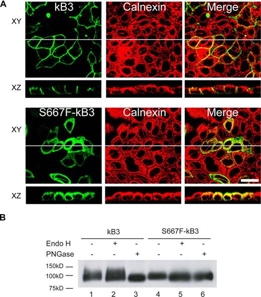 Figure 6. Polarized expression of S667F-kB3 in MDCK1 cells and endoglycosidases treatment. (A) MDCK1 cells stably expressing kB3 or S667F-kB3 that were allowed to polarize for 3 days; their protein expression was induced with sodium butyrate and fixed as described in “Methods.” The cells were then double-labeled with anti–band 3 mouse monoclonal BRIC170 and a rabbit antibody to calnexin, and the bound antibodies were detected with suitable goat anti-mouse or anti-rabbit secondary antibodies and imaged using confocal microscopy. The top panels (XY) show a view parallel to the epithelium, with the BRIC170 image, calnexin, and merged images. The images below (XZ) show a perpendicular view of BRIC170, calnexin, and the merged image of the same epithelium, as represented by the white line in the XY image. kB3 did not overlap with calnexin distribution, and is localized to the basolateral membrane. In contrast, the majority of the S667F-kB3 immunoreactive protein overlaps with the localization of calnexin in polarized cells. Scale bar equals 30 μM. (B) Western blot of kB3 or S667F-kB3 proteins immunoprecipitated with rbB3Ct from one confluent 10-cm2 plate of cells induced with sodium butyrate and treated with either nothing, Endo H (removes high mannose glycosylation), and PNGase (removes complex glycosylation). The immunoprecipitated proteins were eluted and detected by Western blotting using anti–band 3 BRIC170. Normal kB3 protein is complex glycosylated, as evidenced by a diffuse band present in lane 1, which is insensitive to Endo H treatment (lane 2) but runs as a lower-molecular-weight after treatment with PNGase (lane 3). In contrast, S667F-kB3 does not have a diffuse band (lane 4) and is sensitive to Endo H (compare lane 4 with 5), suggestive of high mannose glycosylation only, and consistent with this protein being retained in the ER.