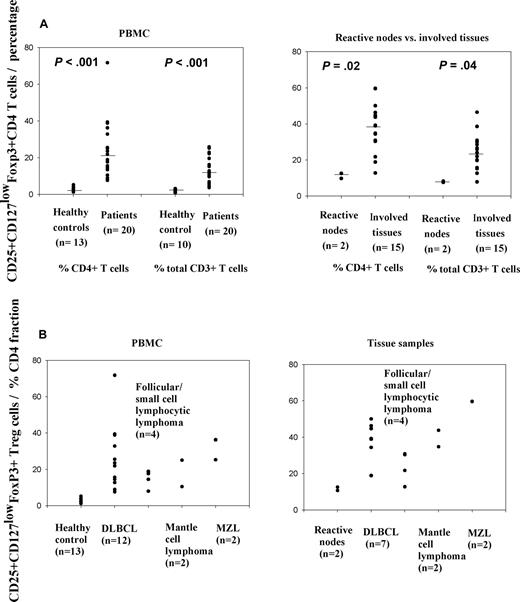Figure 2. Increased numbers of CD25+ Treg cells in patients with different specific subtypes of NHL. (A) Proportions of CD25+ Treg cells in patients' PBMCs and involved tissue samples compared with healthy control PBMCs and reactive nodes, respectively. (B) Proportions of CD25+ Treg cells in PBMCs and involved tissue samples from different specific subtypes of NHL and their comparison with control samples. Data are expressed as percentage of CD4+ T cells. DLBCL indicates diffuse large B-cell lymphoma; MZL, marginal zone lymphoma.