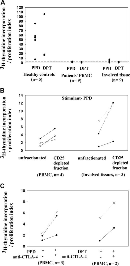Figure 4. Contributions of CD25+ Treg cells to unresponsiveness of patients' T cells from peripheral blood and involved tissue samples. (A) Lack of T-cell proliferation in patients' samples, whereas control PBMC samples demonstrate significant proliferation with control stimuli PPD or DPT. (B) Increased proliferation to PPD by T cells from PBMCs and involved tissue samples after CD25+ cell depletion. (C) Increased T-cell proliferation on adding a blocking anti–CTLA-4 F(ab)2 fragment to patients' PBMC cultures stimulated by PPD or DPT.