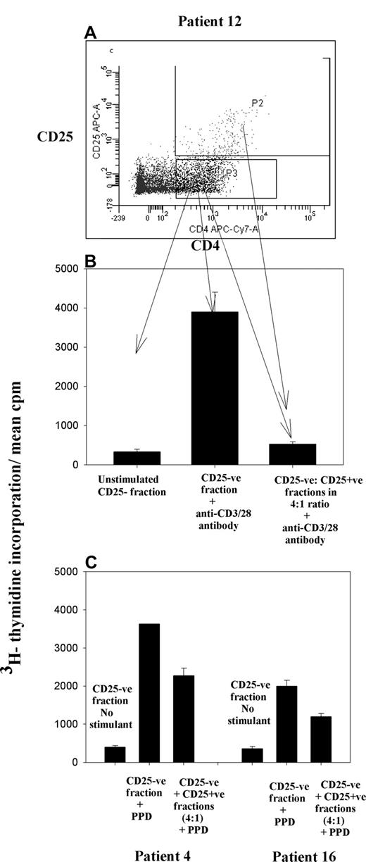 Figure 7. CD25+ Treg cells induced by NHL tumor cells are suppressive. CFSE-labeled CD25− fraction of PBMCs was incubated with tumor cells in the ratio of 1:4. On day 5, induced CD25+ and CD25−CD4+ fractions (n = 3 patients) were sorted by flow cytometry (A) and stimulated with either anti-CD3/28 or the recall antigen PPD. Histogram illustrates inhibition of proliferation of effector cells (CD25− fraction) on addition of CD25+ cells in a ratio of 4:1. (B) Patient 12. (C) Patients 4 and 16. Error bars represent SD.