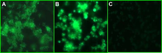 Figure 5. Plasma from patients induced platelet aggregation. Combination of patient plasma (panel A, patient 2; panel B, patient 3) with normal platelets induced CD62 expression on the platelet surface and aggregation not seen when normal heterologous plasma was added to the same platelets (C). The figure shows one representative experiment. Similar results were obtained using plasma from patients 1 and 4.