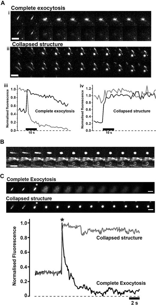 Figure 1. Retention of major WPB core proteins during lingering kiss fusion events. (A) The fate of VWF-EGFP and Proregion-mRFP, co-packaged within the same WPB, following a complete exocytotic event (Ai,iii) or following fusion-evoked collapse (Aii,iv). Ai and ii show montages of images of VWF-EGFP (top panels) and Proregion-mRFP (bottom panels) fluorescence from time-lapse sequences, and Aiii and iv show the time-course for the fluorescence changes for VWF-EGFP (black traces) and Proregion-mRFP (gray traces) during the 2 distinct fusion events. Scale bars are 2 μm, dual-color images were acquired at 0.83 frames per second. (B) A montage of images of a single Proregion-EGFP containing WPBs undergoing fusion in the presence of 7 μM extracellular FM 4-64. FM4-64 labels the WPB membrane only following formation of a fusion pore. The top panel shows Proregion-EGFP fluorescence, the lower panel shows FM 4-64 fluorescence. Images were acquired simultaneously on a Leica SP2 confocal microscope at 7.4 frames per second. The cell was stimulated with histamine (100 μM), the scale bar is 2 μm. (C) In the same format as Panel A, examples of complete exocytosis and collapsed WPB structures containing Proregion-EGFP alone. Images were acquired at 30 frames per second on an epi-fluorescence microscope. For display, images were resampled to a frame every 2 seconds. Frames indicated by the white asterisks correspond to the point on the time-course plot indicated by the black asterisk.