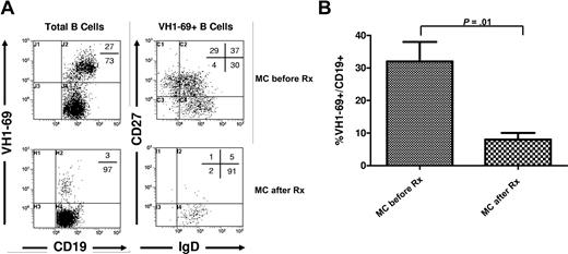 Figure 4. Effects of rituximab on VH1-69 clonal B cells. (A) Flow cytometry figures of a patient with HCV-MC vasculitis demonstrating staining with anti–Vh1-69 gene product mAb (MC pre-Rx) and disappearance of VH1-69+ B cells following rituximab (MC post-Rx). (B) Histogram representing the percentage of VH1-69+ cells among CD19+ B cells (mean ± SEM) in patients with HCV-MC vasculitis (n = 11) before (MC pre-Rx) and after (MC post-Rx) rituximab.