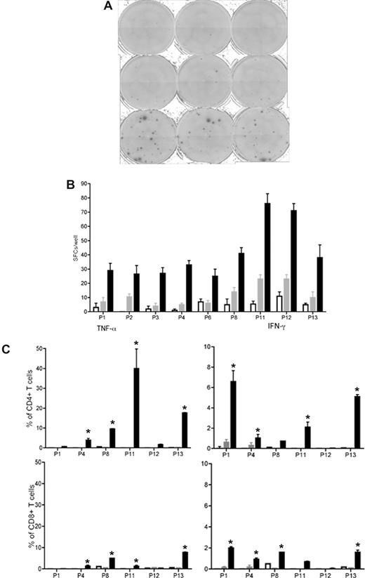 Figure 1. Antileukemia T-cell responses develop in remission after imatinib. (A) IFN-γ ELISPOT data (triplicate) depicted from P12: leukemic cells alone (first row), remission sample alone (second row), and leukemic and remission samples (last row). (B) Detection of antileukemia immune responses in 9 of 14 patients via IFN-γ ELISPOT. Leukemic cells alone (□), remission sample alone (■), and leukemic and remission samples (). The following stimulated remission samples from the patients are shown and depicted as median and range: P1, 5 months; P2, 12 months; P3, 6 months; P4, 18 months; P6, 14 months; P8, 15 months; P11, 4 months; P12, 5 months; P13, 12 months. All responses were statistically significant (P < .05) compared with leukemic or remission samples alone. (C) TNF-α and IFN-γ production (CFC) by CD4+ T and CD8+ T cells in stimulated remission samples (■) from 6 patients. Leukemic cells alone (□) and remission samples alone (). The same remission samples shown in panel B were analyzed (*P < .05, statistically significant responses over background).