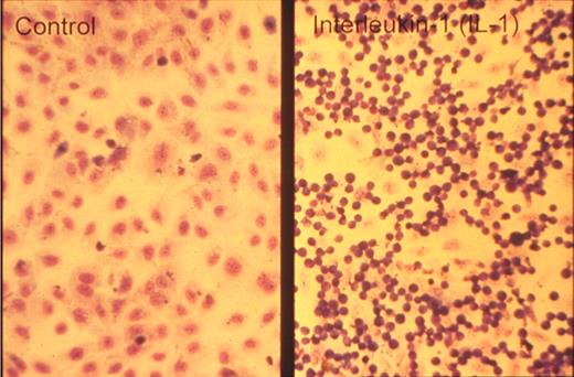 Figure 3. Neutrophils adhere to cytokine-stimulated cultured endothelial cells. Phase-contrast photomicrograph of the adhesion of human neutrophils to control (left) and interleukin-1–treated (right) human umbilical vein endothelial monolayers taken at the end of a 10-minute adhesion assay. Reproduced with permission from American Society for Clinical Investigation.15