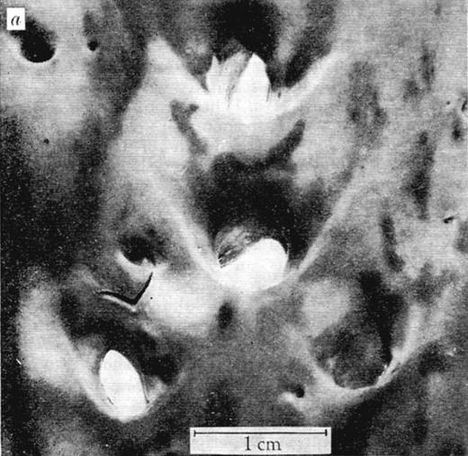 Figure 4. View of human aorta stained with Sudan III for fat deposits/atheroma (dark stains) from the intimal side. Outer wall branches (experiencing disturbed flow) of the celiac, superior mesenteric, and renal arteries show more extensive staining than the inner walls where shear rates are high and laminar. Reproduced with permission from Macmillan Publishers Ltd.42