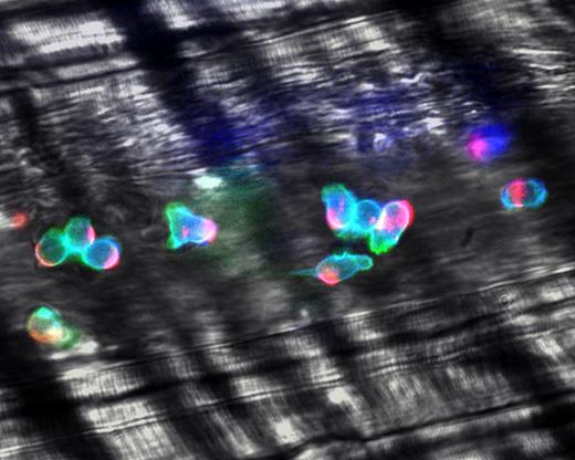 Figure 6. Polarization of adherent leukocytes. In vivo imaging using high-speed high-resolution multichannel fluorescence intravital videomicroscopy of αLβ2 integrin (blue), PSGL-1 (red), and the granulocyte marker Gr-1 (green) expressed on the leukocyte surface in tumor necrosis factor-α (TNF-α) inflamed venules. The majority of leukocytes migrates laterally in inflamed venules. These migrating leukocytes exhibit marked clustering of PSGL-1 at the trailing edge. The large PSGL-1 cluster may contribute to leukocyte recruitment through leukocyte-leukocyte secondary tethers. In contrast, the expression of αLβ2 is relatively homogenous on the leukocyte surface. Reproduced with permission from Nature Publishing Group.90