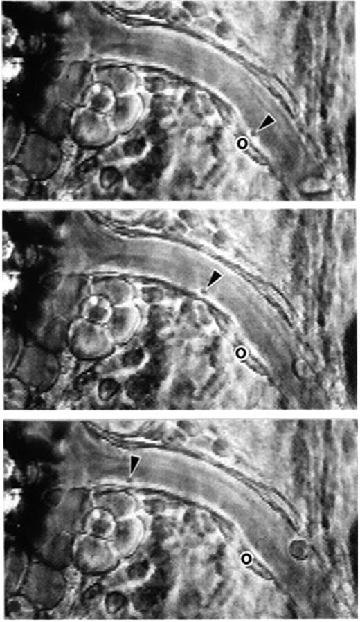 Figure 7. Phase-contrast intravital microscopy showing a platelet rolling on a mesenteric venule after stimulation by the calcium ionophore A23187. “o” indicates the location of the platelet at time 0. Arrowheads point toward the rolling platelet at 0 seconds (top), 1.58 seconds (middle), and 2.96 seconds (bottom). A single much larger and more slowly rolling leukocyte is also seen. Bar represents 30 μm. Reproduced with permission from PNAS.7