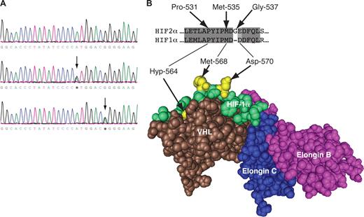 Figure 1. Identification of the c.1603A>G and c.1609G>A mutations in the HIF2A gene. (A) Detection of the c.1603A>G and c.1609G>A mutations by PCR-direct sequencing. PCR was performed on total peripheral blood DNA using a set of primers to specifically amplify exon 12 of the HIF2A gene. Sequencing detected a heterozygous A to G change at base 1603 in patient H2 (middle panel) and G to A at base 1609 in patient H5 (bottom panel) as indicated by arrows compared with wild-type sequence (top panel). Shown are nucleotides 1587 to 1615. Bases are as follows: G, black; A, green; T, red; C, blue. (B) Three-dimensional structure of the VHL:ElonginC:ElonginB complex bound to hydroxyproline-564 HIF-1α peptide (residues 556-575). The structure was generated using Cn3D from PDB coordinates (1LM8) deposited by Min et al.18 The positions of hydroxyproline-564 (Hyp-564), Met-568, and Asp-570 are shown (all in bright yellow). The sequences of HIF-2α and HIF-1α at the primary hydroxylation site are compared, with the corresponding HIF-2α residues indicated.