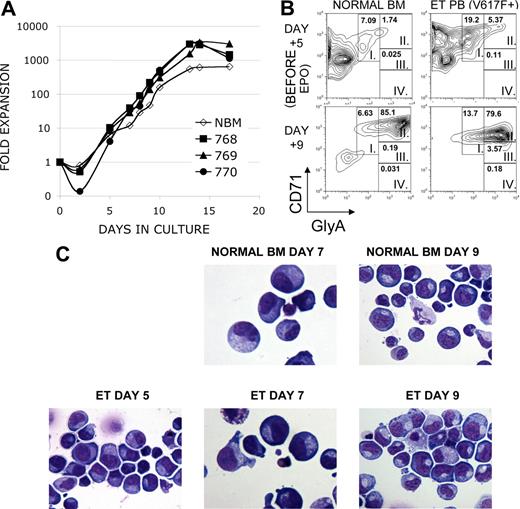 Figure 2. Erythroid expansion and phenotype of cultured primary cells from subjects with MPDs. CD34+ cells were isolated from peripheral blood from a subject with postthrombocythemic myeloid metaplasia (sample no. 768) and peripheral blood (sample no. 770) and bone marrow (sample no. 769) from a subject with ET. Cells were cultured in parallel with CD34+ cells isolated from a healthy bone marrow donor (NBM). Both MPD subjects had the JAK2 V617F+ mutation. Cells were cultured in the presence of IL-3, IL-6 and SCF, and EPO was added on day 5 of culture. (A) Cells were cultured in the presence of IL-3, IL-6 and SCF, and EPO was added on day 5 of culture. Cell number is presented as fold-expansion over the starting number of CD34+ cells. (B) CD71 and Glycophorin A expression was analyzed on cultured cells. Maturation-specific erythroid gates were drawn in accordance with flow cytometry models of murine and human erythroid development, with high expression of CD71 and moderate expression of glycophorin A in the earliest erythroblasts (group I) with successive increases in glycophorin A expression and loss of CD71 as the cells mature (groups II-IV). Shown are a representative MPD sample and NBM sample, EPO-independent erythroid differentiation in analyzed MPD samples (mean 33.7%, n = 3) was significantly greater than NBM samples (mean 6.6%, n = 2, P = .017). (C) Morphologic characterization of cultured cells. Cytospins of cultured cells were stained with a modified Wright-Giemsa stain. Note that before the addition of EPO on day 5, cells from a subject with ET possessed features characteristic of erythroblasts: round nuclei with clumped chromatin, royal blue cytoplasm and a lack of granulation. These features are more prominent following EPO in both healthy and MPD samples.
