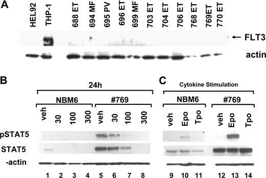 Figure 6. Healthy bone marrow donors have lower levels of total STAT5 expression and STAT5 phosphorylation than MPD samples. Cells from bone marrow CD34+ cells from a subject with ET (769, V617F+) and a healthy donor (NBM6) were grown in parallel for 9 days in the presence of IL-3 (10 ng/mL), IL-6 (10 ng/mL), SCF (25 ng/mL) and EPO (2 U/mL starting on day 5). (A) Cells were counted and replated at 5 × 105 cell/mL and then exposed for 24 hours to lestaurtinib at different concentrations, lysed, and expression of phosphorylated STAT5 and total STAT5 was assayed by Western blotting. (B) After expansion, cells were washed twice in PBS and replated in media lacking all cytokines for 4 hours and then restimulated for 10 minutes with EPO (100 U/mL), TPO (100 ng/mL), or no cytokine control. Cells were collected and lysed. Lysates were analyzed for phospho-STAT5 and total STAT5 expression.