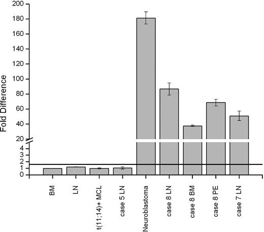 Figure 3. MYCN is up-regulated in MCL cases with t(2;14)(p24;q32). Expression of MYCN in 3 samples (LN, BM, and PE) from case 8 and LN samples from cases 5 and 7. Note up to 90-fold overexpression of MYCN in the analyzed samples from case 8 and case 7 with t(2,14)(p24;q32)/IGH-MYCN. The negative controls and the LN sample from case 5 did not exceed the threshold level (black line) of 1.6. The neuroblastoma case that was used as positive control showed up to 180-fold overexpression of MYCN mRNA. The qRT-PCR data are representative of three independent experiments. Measurements were performed in triplicate and results are means (± SEM).