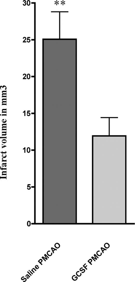 Figure 1. Infarct volumes in vehicle and G-CSF/SCF–treated mice. Columnar graph showing the infarct volume in millimeters cubed in the brains of the saline-treated versus GSCF-treated mice. Values are means plus SEM. **P < .01.