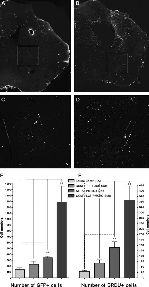 Figure 2. GFP expression and proliferation at 2 months following PMCAO. (A) Coronal section of a vehicle-treated brain at 2 months after PMCAO at the level of the lesion. GFP-immunopositive cells were visualized using amplified immunostaining. (B) Similar level in the brain like in panel A from a mouse that received daily injection of G-CSF/SCF for 5 consecutive days following the stroke. (C,D) Magnifications of the boxed areas in panels A and B, respectively. Note the significantly higher number of green fluorescent cells in the G-CSF/SCF–treated animal's brain. Horizontal side of box equals 500 μm (A,B) and 125 μm (C,D). Panels A,B: objective, 10×; numeric aperture, 0.3, Plan Fluo. (E) Columnar graph showing the mean number of GFP- and (F) BRDU-immunopositive cells in the sections of the saline-treated versus G-CSF–treated mice in both hemispheres.