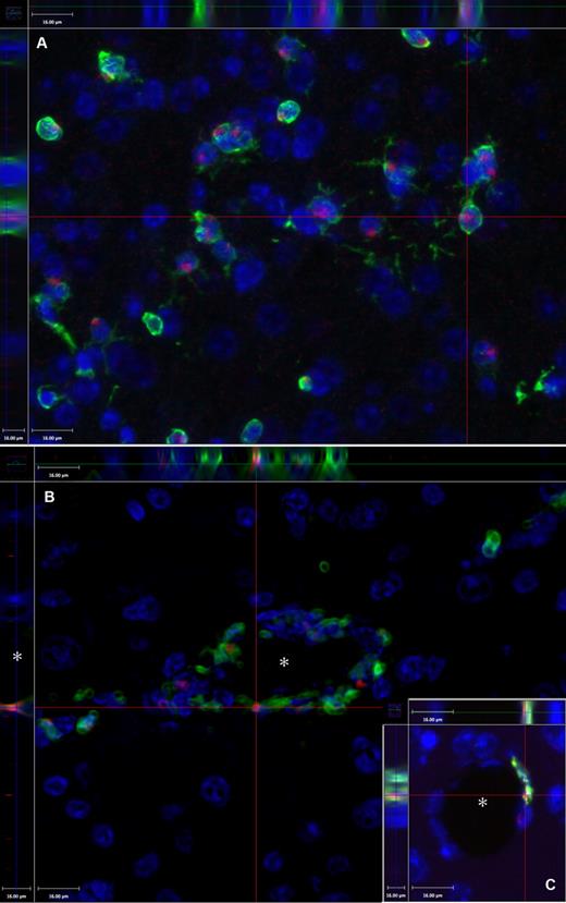 Figure 3. Demonstration of the technique of colocalization of the GFP and the Y chromosome in a female brain at 2 months after PMCAO. Y chromosome hybridization was performed in sex-mismatched GFP BM-transplanted mice brains. (A) Presence of the Y chromosomes in red (Alexa-594); green fluorescence indicates the presence of the GFP, and blue fluorescence labels cell nuclei based on DAPI, a chromosomal stain. The section is one level of a Z-series demonstrating that the Y chromosome is localized in the same cells that are also GFP+ (side panels). (B) Cross-section of a capillary (*) of a Z-series depicting several luminally localized GFP cells that are also positive for the Y chromosome (red dots). The inset (C) shows another example, where the side panel of the confocal image illustrates that the Y chromosome and the GFP colocalize in a cell that borders the vascular lumen (*). Objective, 40×; numeric aperture, 0.6 (A); and objective, 20×; numeric aperture, 0.7 (B). Scale bar equals 16 μm.