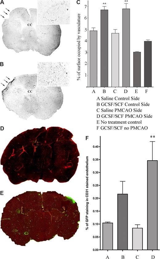 Figure 4. G-CSF/SCF treatment increases angiogenesis and many of the new endothelial cells are of donor BM origin. Vascular density is demonstrated in untreated (A) and G-CSF/SCF–treated (B) mice after stroke (→). The insets are high-magnification representative images of coronal sections from similar rostro-caudal levels of the brains. (C) Columnar graph showing the percentage of the surface area occupied by vessels based on alkaline phosphatase staining in the sections of the saline-treated versus G-CSF/SCF–treated mice in both hemispheres. Vascular density is demonstrated in untreated (D) and G-CSF/SCF–treated (E) mice after stroke. The vascular endothelial cells are immunostained for CD31 (red fluorescence due to Alexa-594), and the GFP cells are immunostained in green following signal amplification using FITC-tyramide. For panels A,B,D,E: objective, 10×; numeric aperture, 0.3, Plan Fluo. Note the increased density of vessels as well as more green vascular structures in the G-CSF/SCF–treated brain. (F) The columnar graph demonstrates the percentage of GFP+ (ie, BM-derived; green) cell surfaces compared with all (red) endothelial (CD31-stained) surfaces in the saline-treated versus G-CS/SCF–treated mice brains in both hemispheres (n = 4). Values are means plus SEM. **P < .01. CC indicates corpus callosum; v, lateral ventricle.