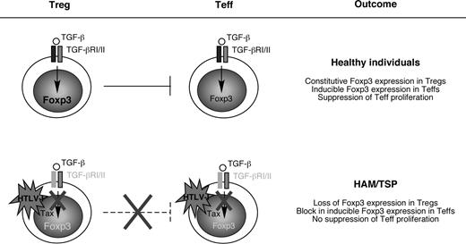 Figure 4. Loss of immune tolerance caused by HTLV-I Tax. In healthy individuals, CD4+CD25+Foxp3+ Tregs suppress the proliferation of Teffs through (1) constitutive expression of Foxp3, and (2) induction of Foxp3 expression in Teffs (also known as infectious tolerance). However, in patients with HAM/TSP, HTLV-I Tax down-regulates TGF-βRII, which silences TGF-β–responsive genes such as foxp3. The resulting block in Foxp3 expression causes Tregs to lose suppressor function and causes Teffs to become resistant to TGF-β–inducible Foxp3 expression. The result is a breakdown in immune tolerance in patients with HAM/TSP characterized by expansion of potentially pathogenic CD4+ and CD8+ T cells and production of proinflammatory cytokines.