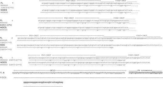 Figure 4. Results of sequencing of IGH gene rearrangements or JH/BCL2 breakpoint regions. All of the sequences are arranged with the specimen sequence at the top, compared with the lower IMGT gene bank sequence. The dashes indicate the sequence is identical to the gene bank sequence, and the nucleotides indicate areas where they differ. Illustrated are cases 1 and 4 (Fr2) and cases 2 and 5 (Fr 3). While the FL and H/DC paired samples from case 2 are similar, the H/DC tumor biopsied 12 years after the FL demonstrates additional mutations. Sequencing of BCL2/JH breakpoint region obtained with MBR probe is illustrated in case 8.