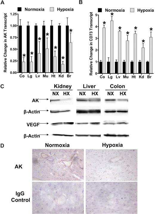 Figure 2. Adenosine kinase (AK) expression during hypoxia in vivo. (A) C57BL/6 mice were exposed to ambient hypoxia (8% oxygen) or normoxia for 4 hours. The colon (Co), lungs (Lg), liver (Lv), muscle (Mu), heart (Ht), kidneys (Kd), and brain (Br) were harvested and AK or CD73 transcript was determined relative to β-actin by real-time RT-PCR (*P < .05). (B) Western-blot analysis of AK or VEGF protein from kidney, liver, or colon. (C) Normoxic or hypoxic cardiac tissue was harvested and stained with AK antibody. Note attenuated AK staining in hypoxic vasculature (magnification, ×400). IgG controls were used at identical concentrations and staining conditions as the target primary antibodies for AK. (D) The tissue was fixed in Tissue-Tek (Sakura) and cut in 3-μm slices, mounted on glass sildes, air dried, post-fixed in chilled methanol for 10 minutes, and permeabilized in chilled acetone for 1 minute. Immunohisto-chemical stainings were performed with polyclonal rabbit anti-AK antibody (dilution 1:100; Santa Cruz Biotechnology, Santa Cruz, CA) for AK and rabbit IgG serum (1:100; Santa Cruz Biotechnology) for isotype control. First endogneous peroxidase activity was quenched by incubating the specimens for 30 minutes with DAKO peroxidase blocking buffer (DAKO, Hamburg, Germany). Primary antibodies were applied for 30 minutes. Incubation with the DAKO evision secondary antibody followed for another 30 minutes. Staining was completed by 10-minute incubation with 3,3′-diaminobenzidine (DAB)+ substrate chromogen, which results in a brown-colored precipitate at the antigen side, and a hematoxylin counterstaining for 2 minutes. Evaluation of the immunohistochemical staining was performed using a LEITZ DMRBE light microscope (40×/0.75 lens), Leica DC300F camera, and Leica QWin software (Leica, Heidelberg, Germany).