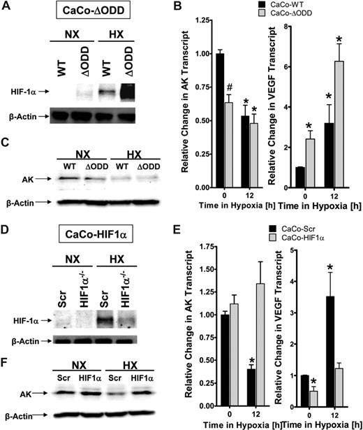 Figure 4. HIF-1α in epithelial adenosine kinase (AK) repression. (A) Characterization of CaCo-2 intestinal epithelia expressing oxygen-stable HIF-1α (CaCo-ΔODD) by Western blot analysis. (B) Confluent monolayers of control (CaCo-WT, ■) or oxygen-stable HIF-1α expressing (CaCo-ΔODD, ) cell lines were exposed over indicated time periods to hypoxia (2% oxygen). Total RNA was isolated and AK or VEGF transcript was determined by real-time RT-PCR. Results are derived from 3 experiments (*P < .05 indicates differences between normoxia and hypoxia; #P < .05 between different cell types). (C) Western blot analysis of AK protein during similar conditions. (D) Characterization of CaCo-2 intestinal epithelia with psiRNA repression of HIF-1α (HIF1α−/−) or control transfected cells (Scr) by Western blot analysis. (E) Confluent monolayers of control (CaCo-Scr, ■) or HIF-1α–silenced CaCo-2 cells (CaCo-HIF1α) were exposed over indicated time periods to hypoxia (2% oxygen) and AK or VEGF transcript was determined by real-time RT-PCR (*P < .05 indicates differences between normoxia and hypoxia). (F) Western blot analysis of AK protein during similar conditions.