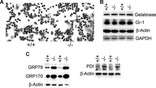 Figure 1. Increase in the expression of ER chaperones in neutrophils of GSD-Ib mice. Peritoneal neutrophils were isolated from 6- to 7-week-old unaffected (+/+) and GSD-Ib (−/−) mice during thioglycollate-elicited peritonitis. (A) Hema 3–stained cytospins of peritoneal neutrophils. (B) Western-blot analysis of protein extracts of peritoneal neutrophils using antibodies against gelatinase, Gr-1, β-actin, or GAPDH. Each lane contains 50 μg protein. (C) Western-blot analysis of protein extracts of neutrophils using antibodies against GRP78, GRP170, PDI, or β-actin. Each lane contains 50 μg protein.