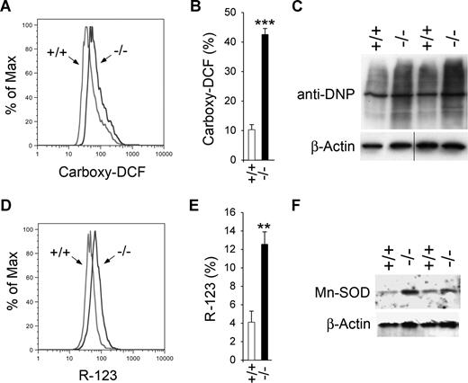 Figure 3. GSD-Ib neutrophils exhibit oxidative stress. Peritoneal neutrophils were isolated from 6- to 7-week-old unaffected (+/+) and GSD-Ib (−/−) mice during thioglycollate-elicited peritonitis. (A) Representative flow cytometric analysis of neutrophil carboxy-DCF staining. (B) Quantification of carboxy-DCF–positive neutrophils determined by immunofluorescence staining. Data represent the means (± SEM) of 3 independent experiments. ***P < .001. (C) Oxyblot analysis of carbonyl groups in oxidative modified proteins. Each lane contains 50 μg protein. The vertical line has been inserted to indicate a repositioned gel lane. (D) Representative flow cytometric analysis of neutrophil R-123 staining. (E) Quantification of R-123–positive neutrophils determined by immunofluorescence staining. Data represent the means (± SEM) of 3 independent experiments. **P < .001. (F) Western blot analysis of protein extracts of neutrophils using antibodies against Mn-SOD or β-actin. Each lane contains 50 μg protein.