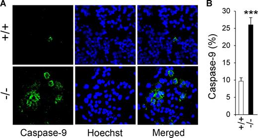 Figure 6. Caspase-9 activation in GSD-Ib neutrophils. Peritoneal neutrophils were isolated from 6- to 7-week-old unaffected (+/+) and GSD-Ib (−/−) mice during thioglycollate-elicited peritonitis. (A) Immunofluorescence of active caspase-9 staining (green fluorescence) and Hoechst 33342 nuclei staining (blue fluorescence), magnification ×400. (B) Quantification of caspase-9–positive neutrophils in unaffected and GSD-Ib mice. Data represent the means (± SEM) of 3 independent experiments. ***P < .001.