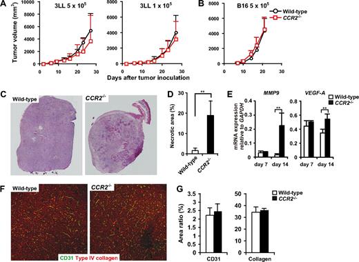 Figure 7. Tumor development and angiogenesis in CCR2−/− mice. (A) WT (n = 8) and CCR2−/− (n = 7) mice were inoculated with 5 × 105 or 1 × 105 3LL cells. (B) WT (n = 8) and CCR2−/− (n = 9) were inoculated with 5 × 105 B16 cells. Each time point represents the mean (± SD). (C) Cryosections of 8- to 10-mm tumors from CCR2+/+ or CCR2−/− mice were subjected to hematoxylin and eosin staining. Representative image from 5 mice for each group. Original magnification, ×50. Whole tumor images were reconstituted with Adobe Photoshop (Adobe Systems, Mountain View, CA). (D) Percentage of necrotic area in the tumors from CCR2+/+ or CCR2−/− mice. Graph represents the mean (± SD) of 5 mice. (E) mRNA expressions of MMP9 and VEGF in the tumor of WT and CCR2−/− mice. Graph represents the mean (± SD) of 4 mice. (F) Cryosections of 8- to 10-mm tumors from CCR2+/+ or CCR2−/− mice were stained with antibodies to CD31 (green) and type IV collagen (red). Representative images of non-necrotic area. Original magnification, ×100. (G) Percentage of CD31- or Type IV collagen-positive areas in non-necrotic area. Graph represents the mean (± SD) of 5 mice.