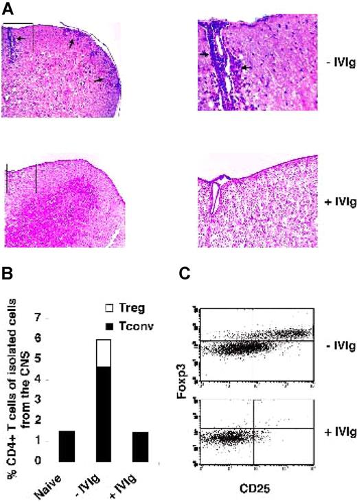 Figure 4. IVIg prevents CNS infiltration by T cells. (A) Histologic analysis of the cervical spinal cord of untreated (top) and IVIg-treated (bottom) mice stained with haematoxylin/eosin. Arrows indicate areas of spinal cord infiltrated by perivascular and subpial leukocyte aggregates. Left, 100×, right, 400× views of regions corresponding to boxed areas. (B) CNS cells isolated by percoll from 3 naive, IVIg-treated and -untreated mice were stained on day 27 after EAE induction and analyzed by FACS. Results are presented as percentage of Treg (▭) and Tconv () CD4+ T cells among the cells isolated from the CNS (mean of 3 mice). (C) Representative plots from individual mice, gated on CD4+.