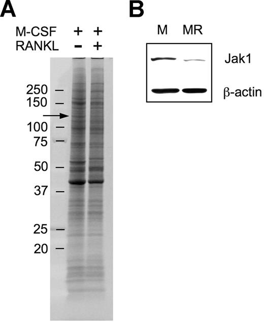Figure 1. Proteomic identification of Jak1 as a protein whose expression was decreased during early osteoclast differentiation. (A) BMMs were incubated with 30 ng/mL M-CSF in combination with 200 ng/mL RANKL for 36 hours. At the end of incubation, cell-surface proteins were biotinylated and isolated. The biotinylated proteins were separated on an 8% to 16% SDS gel and visualized by SYPRO Ruby staining. Protein bands showing differential expression in RANKL-stimulated cells were subjected to LC/MS/MS analysis for protein identification. Arrow indicates the protein band in which Jak1 was included. (B) The decreased expression of Jak1 in RANKL-stimulated cells was confirmed by Western blotting. BMMs were cultured with 30 ng/mL M-CSF alone (M) or M-CSF plus 200 ng/mL RANKL (MR) for 36 hours, and total-cell lysates were subjected to SDS-PAGE followed by immunoblotting using anti-Jak1 antibody. Antiactin blot was shown to ensure same loading between the 2 lanes.