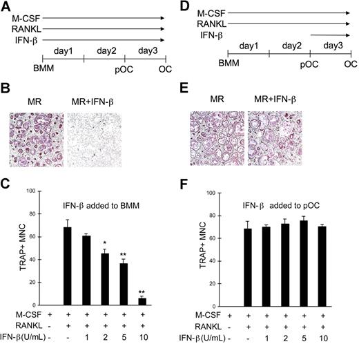 Figure 4. pOCs were not susceptible to the IFN-β–mediated inhibition of osteoclastogenesis. (A) BMMs were cultured with M-CSF (30 ng/mL) and RANKL (100 ng/mL) for 3 days. IFN-β was added at the start of culture for experiments described in panels B and C. (B) At the end of culture, cells were fixed and stained for TRAP activity. Osteoclasts were identified as TRAP+ (purple) multinuclear cells. MR represents M-CSF plus RANKL. Results are representative of at least 3 experiments using 10 U/mL IFN-β. (C) OC numbers were counted after a 3-day culture of BMMs with M-CSF and RANKL in combination with IFN-β. Cells were counted in 3 random fields. Results are presented as means plus or minus SD and are representative of at least 3 experiments with similar results. Asterisks represent statistical difference between the values obtained from cells cultured with or without IFN-β in the presence of M-CSF and RANKL (*P < .05; **P < .01). (D) BMMs were first differentiated into pOCs by incubating cells with M-CSF and RANKL for 2 days, and IFN-β was added at the end of day 2 for experiments in panels E and F. (E) After a 3-day culture, cells were stained for TRAP activity. (F) OC numbers were counted after a 3-day culture of BMMs with M-CSF and RANKL. Varying concentrations of IFN-β were added for the final 24 hours. Data are presented as in panel C.