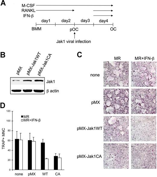 Figure 5. Jak1 overexpression sensitized pOCs to the IFN-β-mediated inhibition of osteoclastogenesis. (A) BMMs were first differentiated into pOCs by culturing with M-CSF (30 ng/mL) and RANKL (100 ng/mL). After the infection with viruses harboring empty vector (pMX), WT Jak1 (pMX-Jak1WT), or constitutively active Jak1 (pMX-Jak1CA), cells were further differentiated into OCs with RANKL in the presence or absence of IFN-β (10 U/mL). (B) At 1 day after Jak1 viral infection, total-cell lysates were investigated for Jak1 expression by Western blotting. (C) At the end of culture, cells were stained for TRAP activity. MR represents M-CSF plus RANKL. Results are representative of at least 3 experiments with similar results. (D) OC numbers in panel C were counted. Data are means (± SD) from 3 random fields in representative experiment.