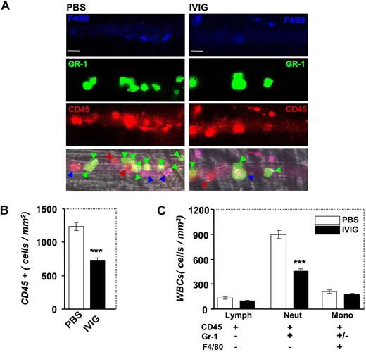 Figure 8. Effect of IVIG on the recruitment of leukocyte subsets by multichannel fluorescence intravital microscopy. (A) Leukocyte subsets were identified by injection of low doses of antibodies against CD45 (red), Gr-1 (green), and F4/80 (blue). Colored arrowheads indicate adherent leukocytes in representative venules according to their subset identification with this method. Bar, 20 μm. (B) IVIG reduces the number of CD45 + cells. ***P < .001. (C) IVIG significantly reduced the recruitment of neutrophils (CD45 + Gr-1 + F4/80−) but did not affect the recruitment of monocytes (CD45 + F4/80 +) and lymphocytes (CD45 + Gr-1−F4/80−). ***P < .001.