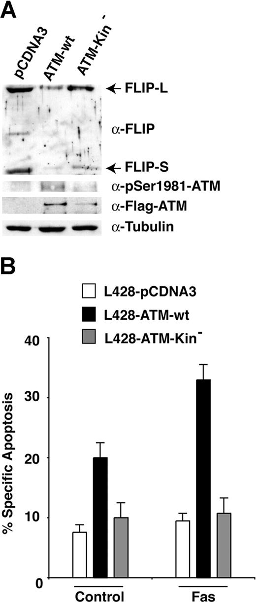 Figure 7. ATM kinase activity down-regulates FLIP protein levels and sensitizes Hodgkin lymphoma cell lines to Fas-induced apoptosis. (A) L428 HL cells were transiently transfected with the indicated constructs along with GFP. Twenty-four hours after transfection, GFP-positive cells were isolated by FACS sorting, and incubated for an additional 12 hours. For immunoblotting, 80 to 100 μg protein extract were separated by SDS-PAGE and transferred on nitrocellulose. The proteins of interest and their phosphorylation were revealed by immunoblotting with specific antibodies. (B) L428 HL cells were transiently transfected with the indicated constructs along with GFP. Twenty-four hours after transfection, cells were stimulated to undergo apoptosis with 250 ng/mL anti-Fas mAb. Apoptosis was determined by the analysis of annexin V binding 24 hours after anti-Fas treatment, upon FACS sorting of GFP-positive cells.